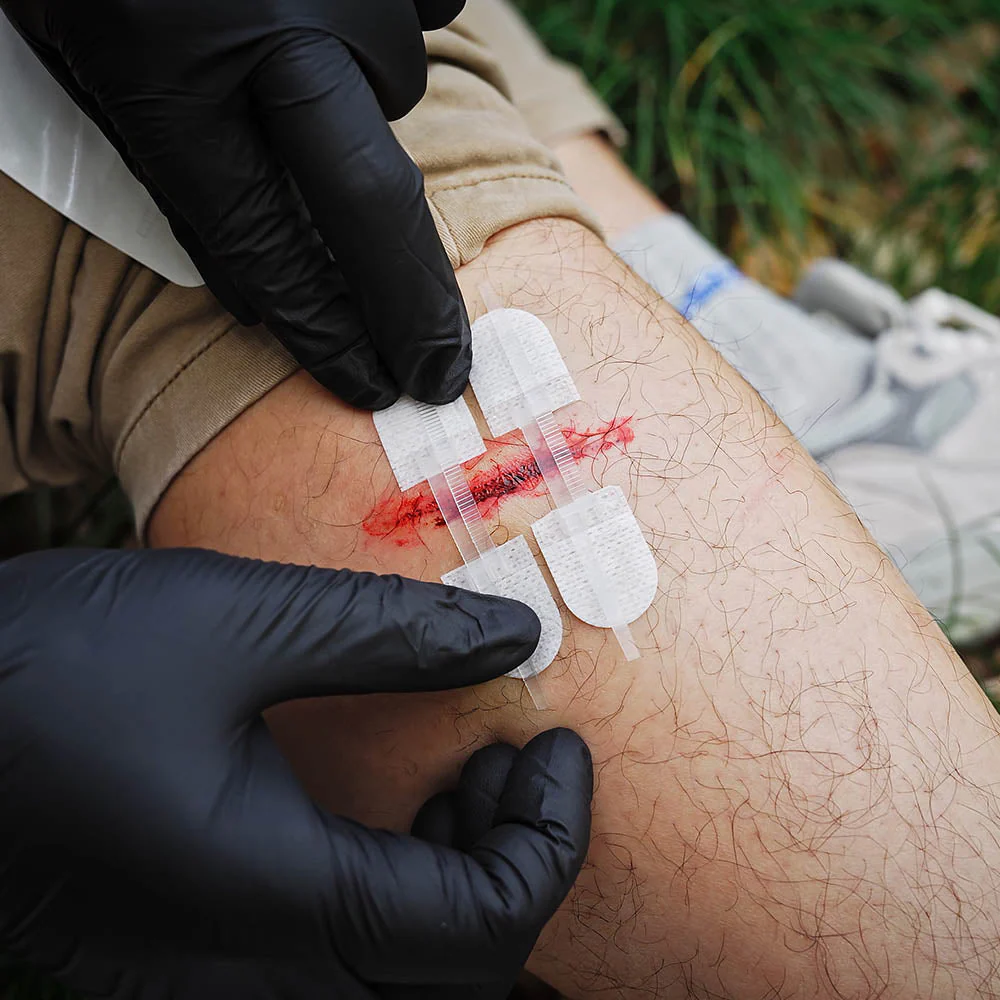 Wound Closure Kit——Rhino Rescue™ Laceration Kit Premium Wound Closure Kit Strips for Cuts and Scrapes - FDA CE Approved - Image 16