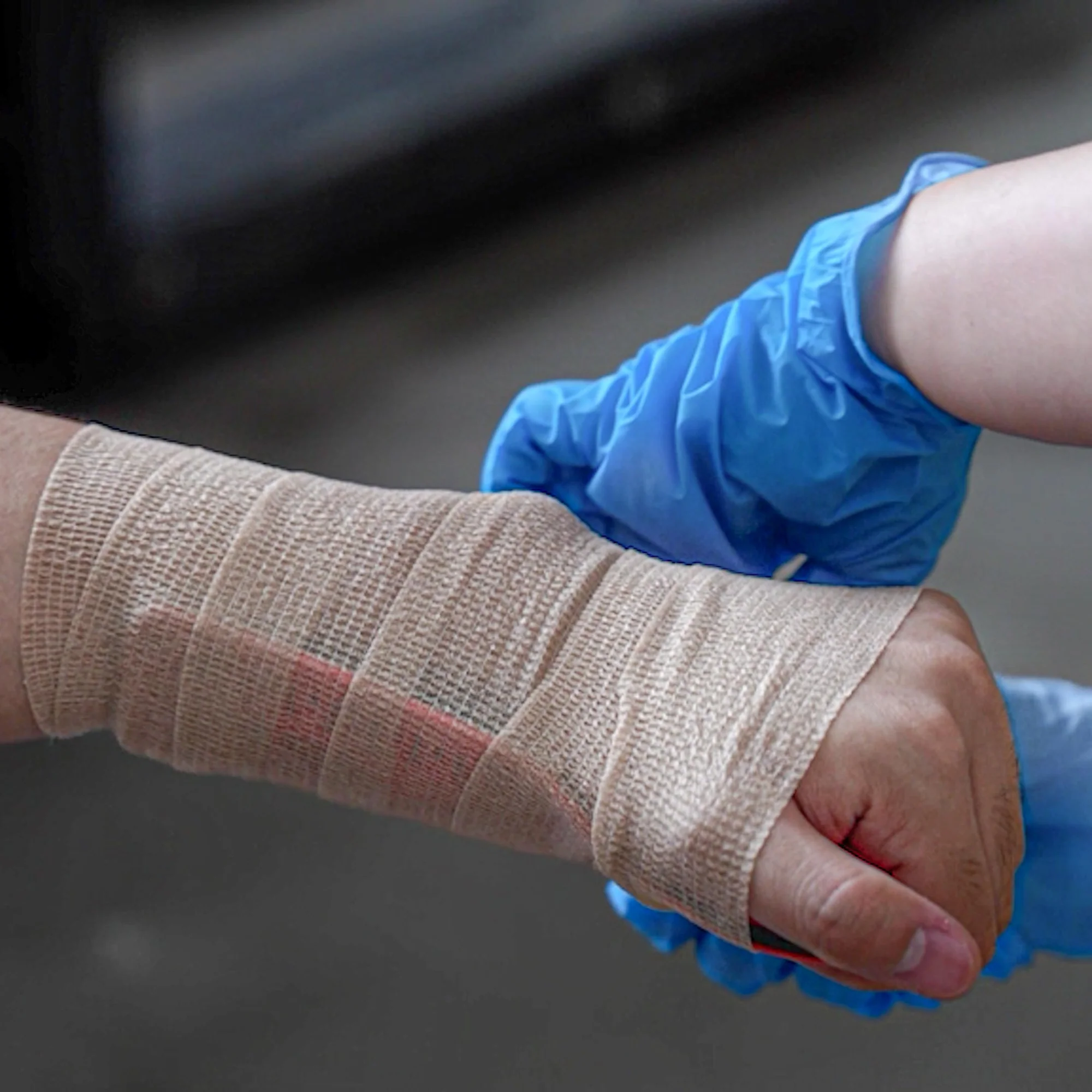 Rhino Rescue™ First Aid Splint Medical Splint Kits Folded for Bone Fractures Keep Bones in Position (Folded) - Image 4