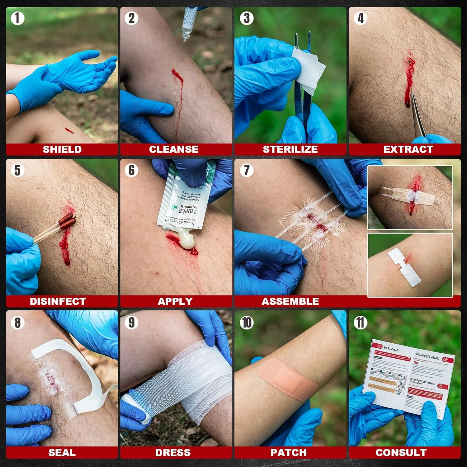 Triple-Action Wound Closure Kit –  3/5/10 Packs, Stitch-Free Healing System for Outdoors & Home - Image 6